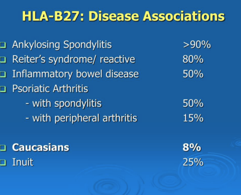 HLA-B27 disease associations