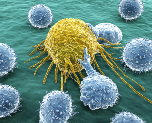 T-lymphocytes attack a migrating cancer cell.